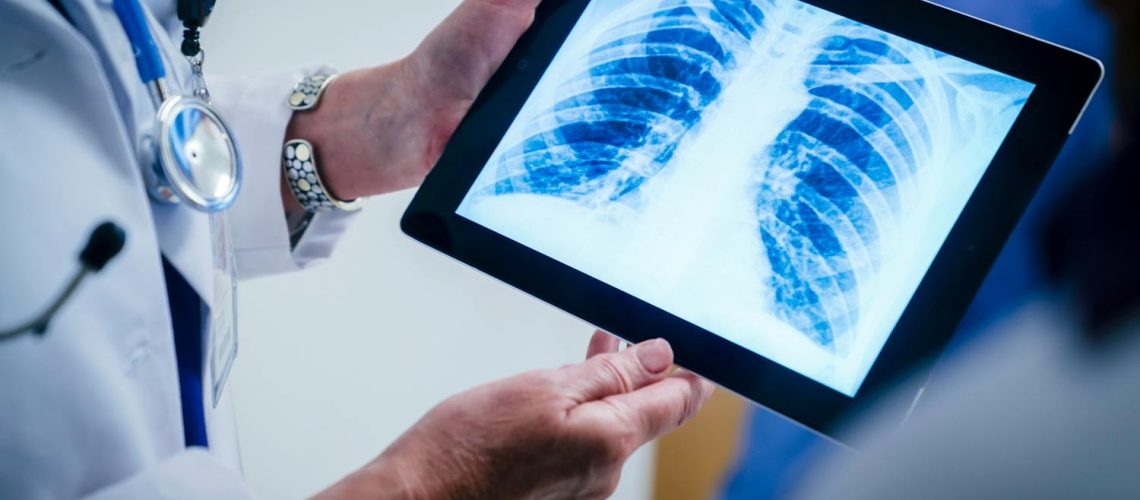 Cage thoracique : tout savoir sur les fausses côtes